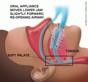 Oral therapy