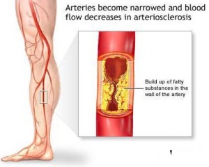 illnesses associated with diabetes